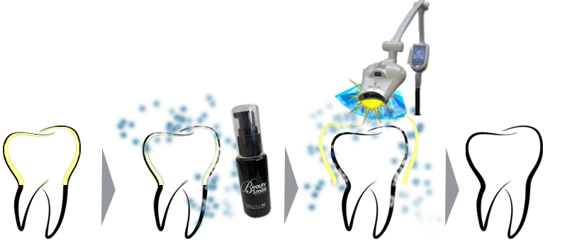 ビューティースマイルホワイトニングの仕組み